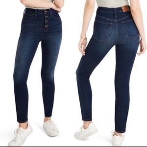 Madewell 10” High Rise Exposed Button Fly Dark Wash Skinny Jeans Size 25